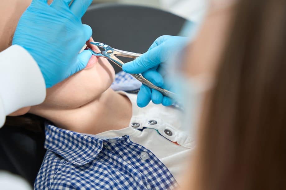What is the Right Time to Get a Tooth Extracted?